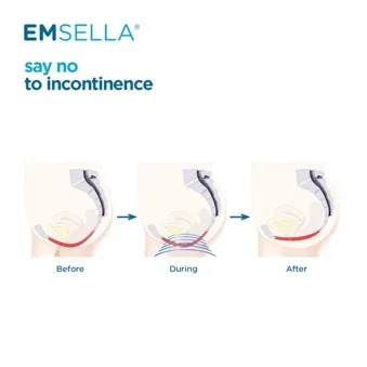 A diagram showing the pelvic floor before, during and after an Emsella treatment