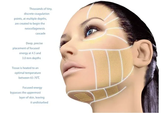 A face marked with a grid of treatment points, annotated with depths and temperature