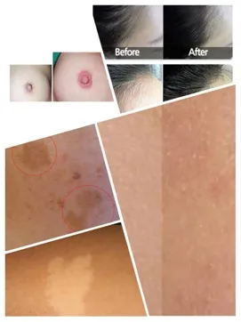 The same brow at three stages of cosmetic tattooing